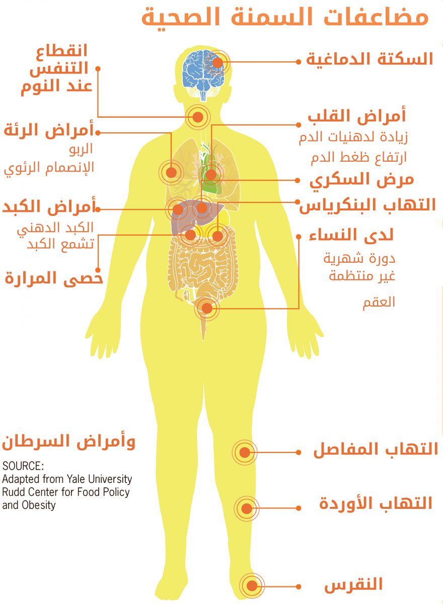 انفوجرافيك: مضاعفات السُّمنة الصحية