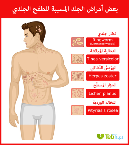 امراض واشكال طغح الجلد