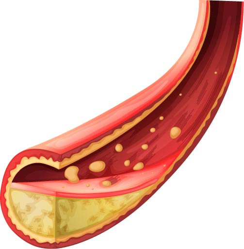 معدل الكوليسترول الطبيعي في الدم يتعلق بنوع الكوليسترول حيث تقاس عادة ثلاثة انواع من الكوليسترول
