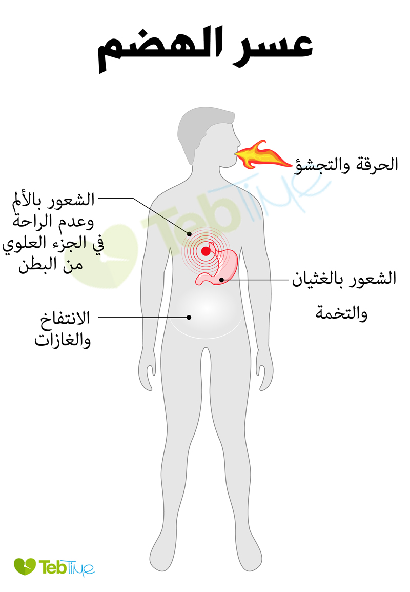 اكثر الاعراض شيوعاً لعسر الهضم