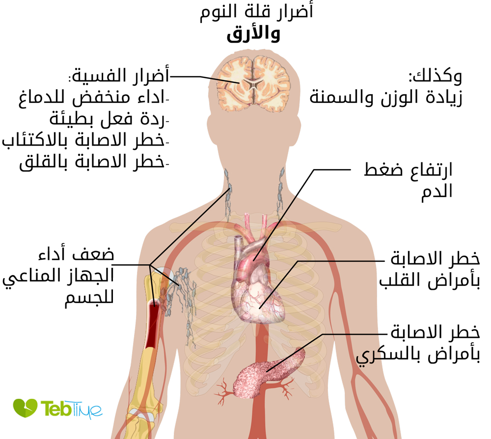 الاثار السلبية للأرق وقلة النوم علي صحة الجسم